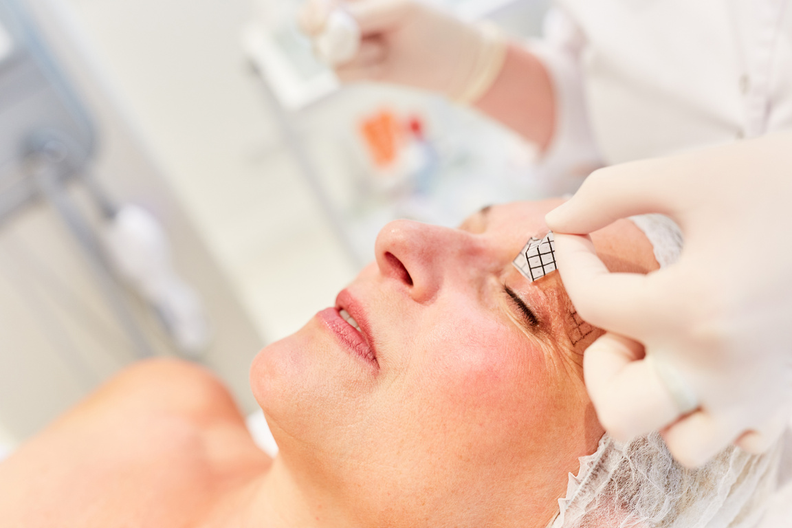 Patient Receives Eyelid Marking for Surgery